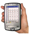 Pocket ECG